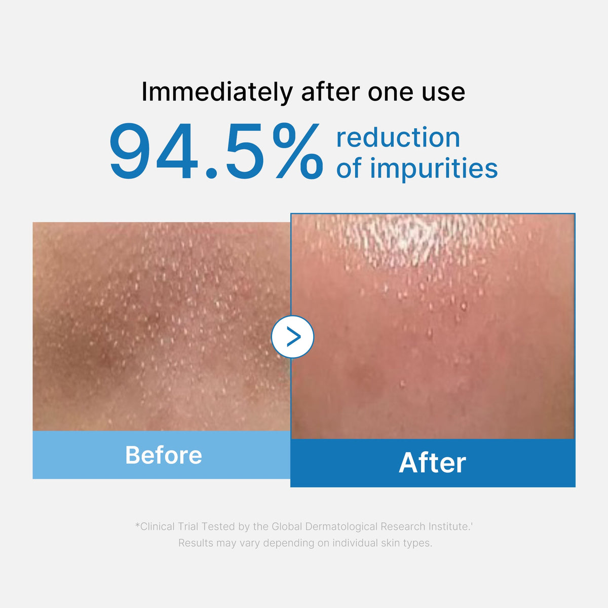 Zero Pore Blackhead Deep Cleansing Oil P6