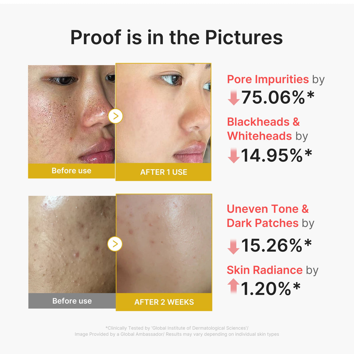 Kojic Acid Turmeric Peel Shot U5