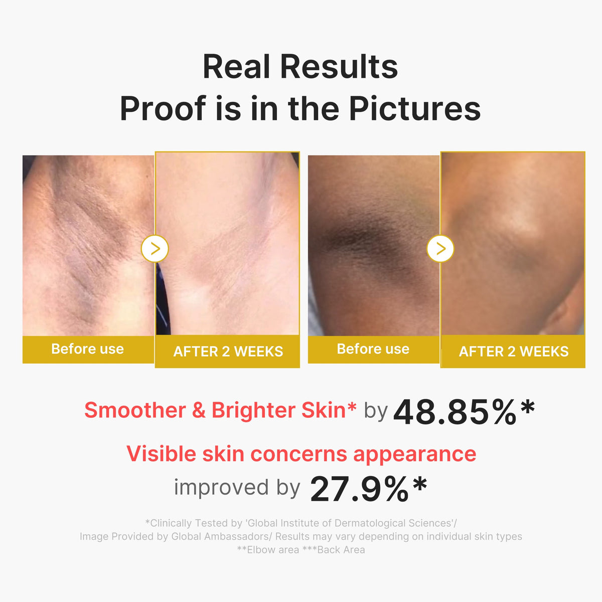 Kojic Acid Turmeric Body Peel Shot X1