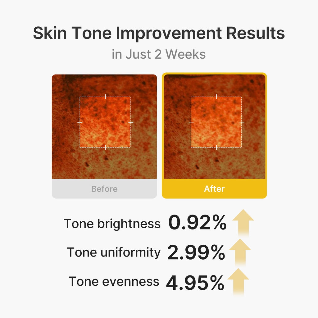 Kojic Acid Turmeric Vita Capsule Cream Z2