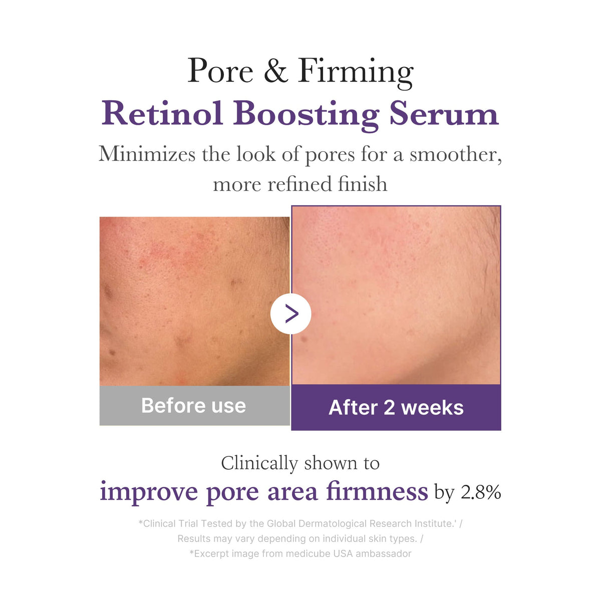 Retinol NMN Boosting Serum M4