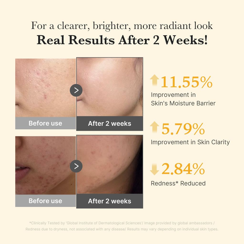 Kojic Acid Turmeric Capsule Serum K9