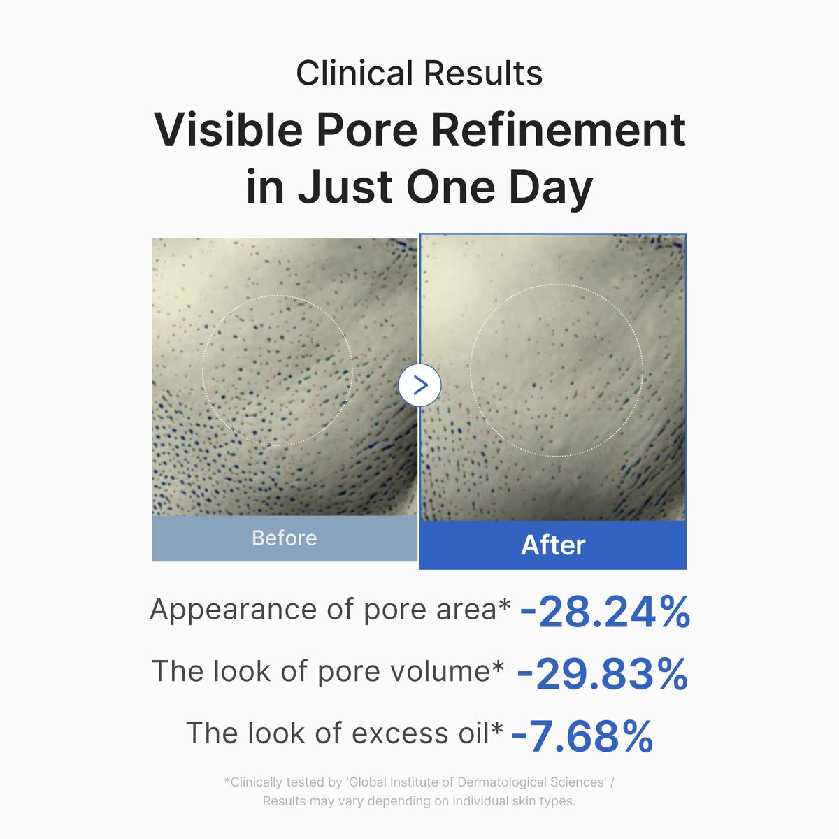 Zero Pore One-day Peptide Serum U5