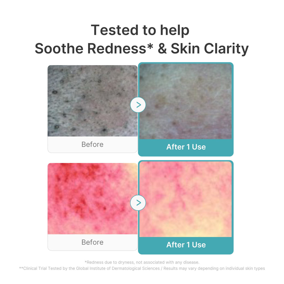 Azelaic Acid Capsule Foam Cleanser S4