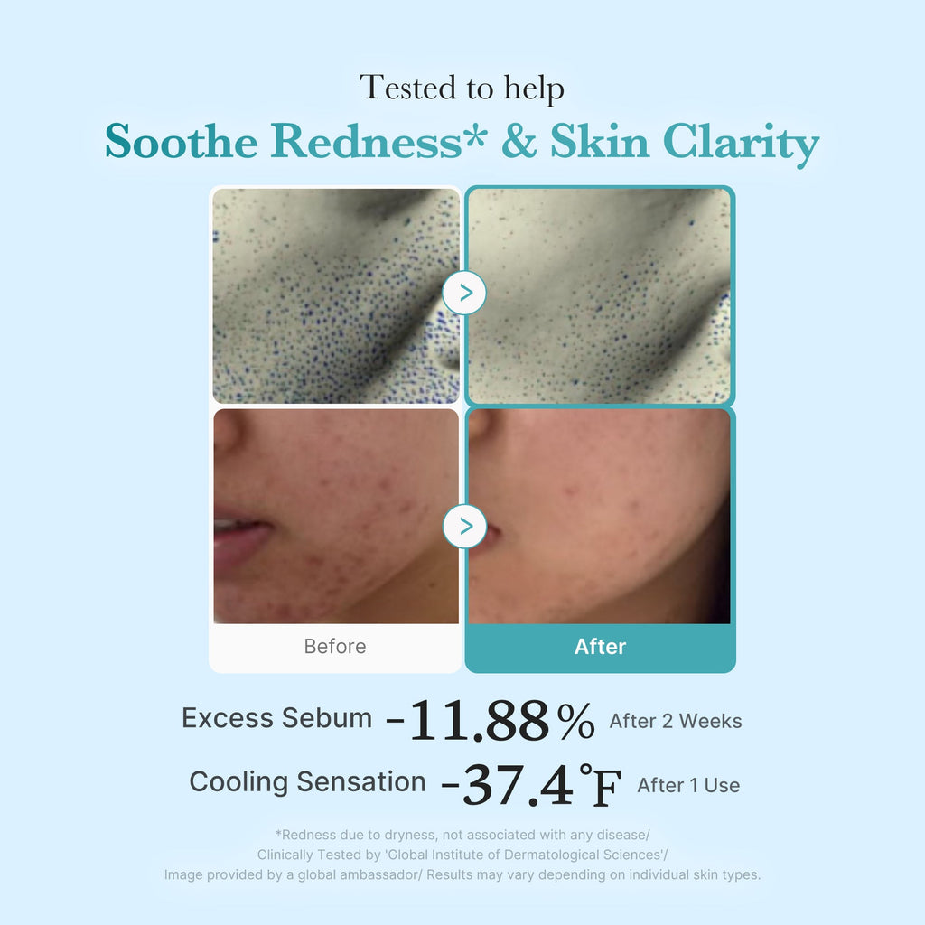 Azelaic Acid Niacinamide Clarifying Toner E4