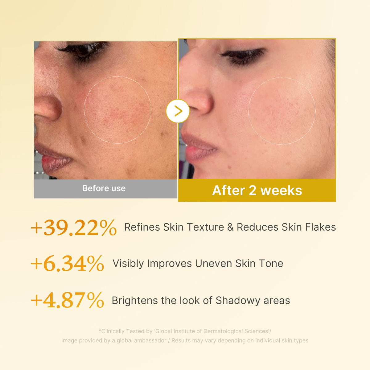 Kojic Acid Turmeric Toner R1