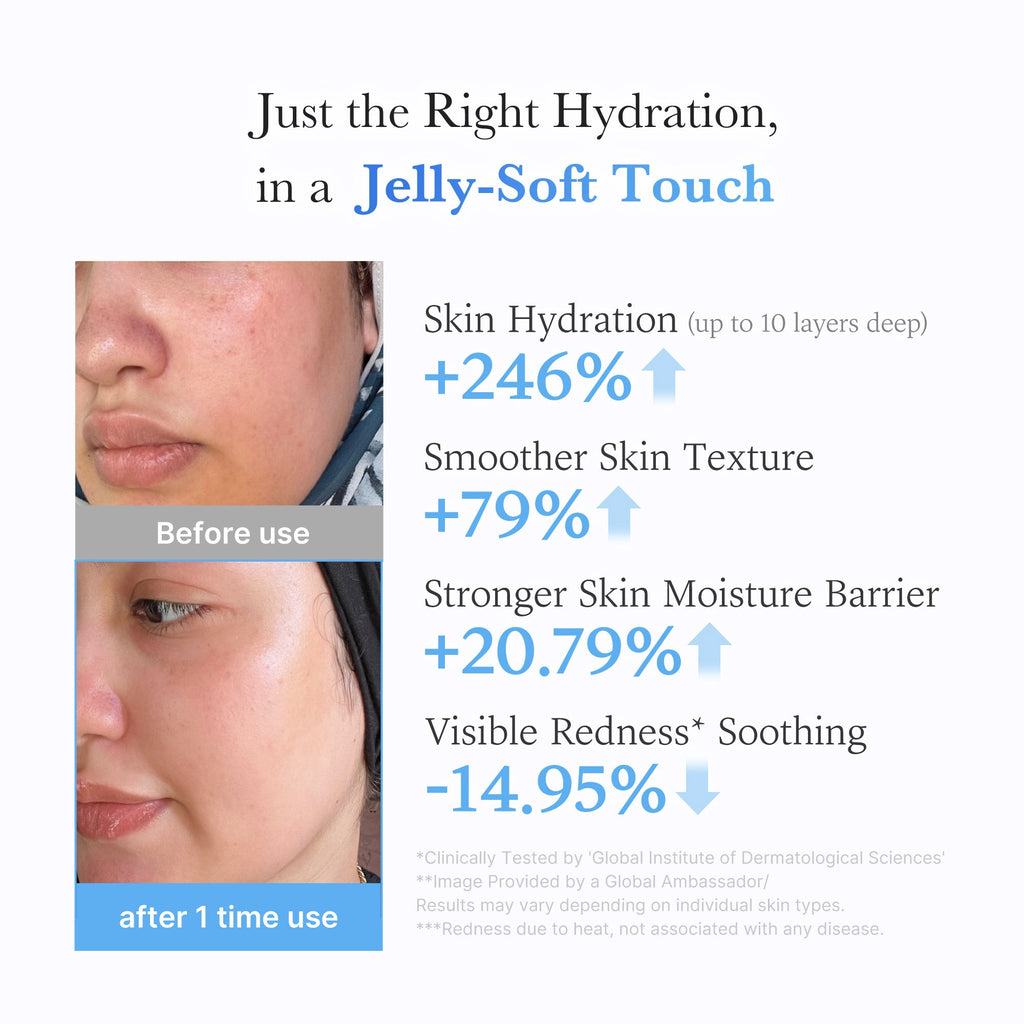 Hyaluronic Ceramide Moisturizing Jelly Cream L2