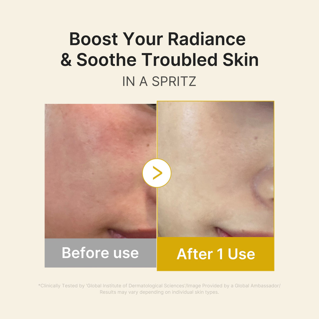 Kojic Acid Turmeric Vitamin Gold Jelly Mist Serum N9