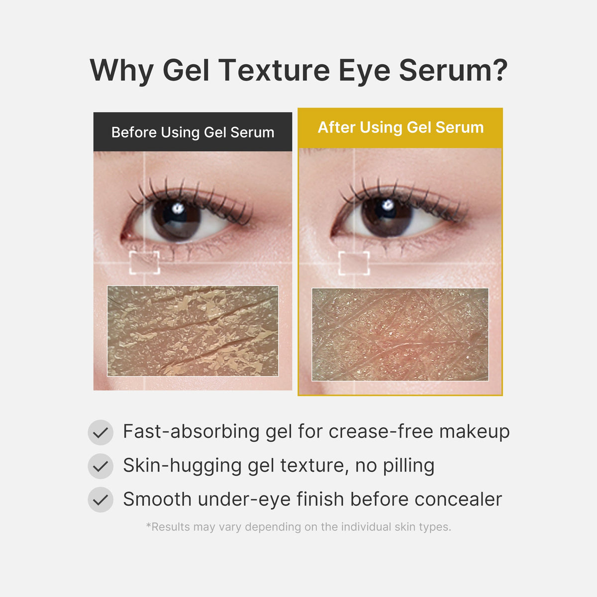 Kojic Acid Tumeric Eye Gel Serum P2