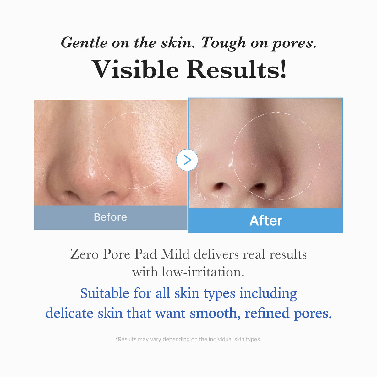 Zero Pore Madecassoside Pads (Mild) M2