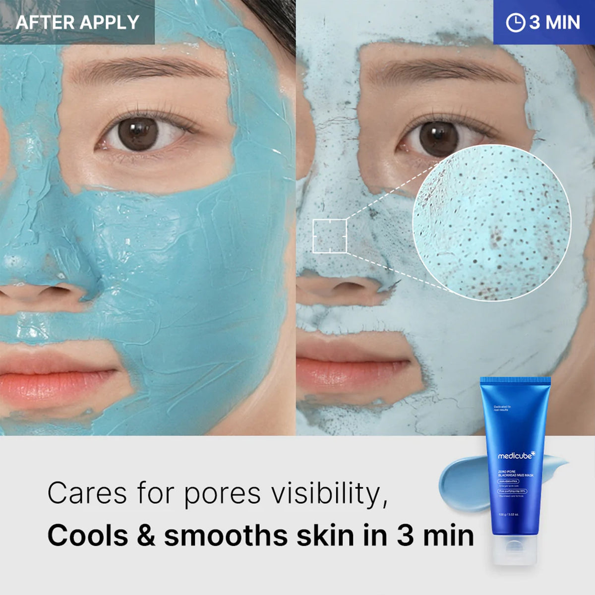 Zero Pore Blackhead Mud Mask W4