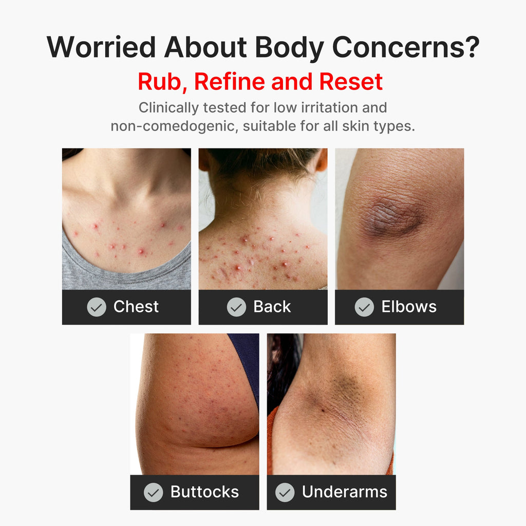 Kojic Acid Turmeric Body Peel Shot V2