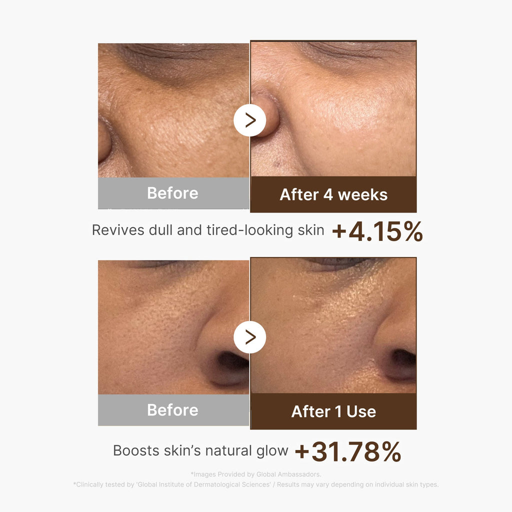 Deep Vitamin C Capsule Serum P0
