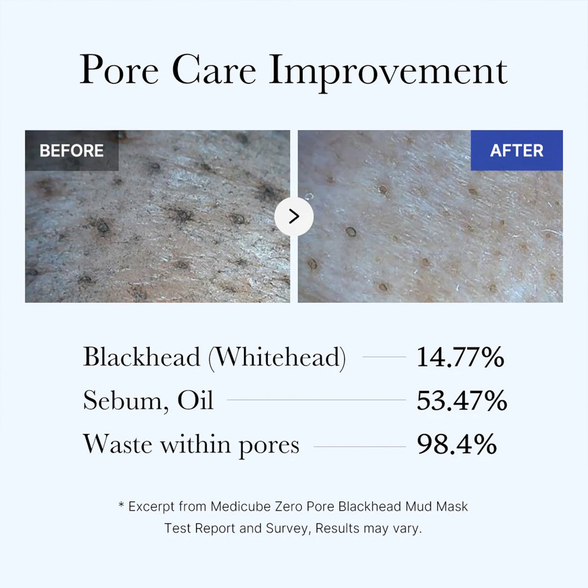 Zero Pore Blackhead Mud Mask R4