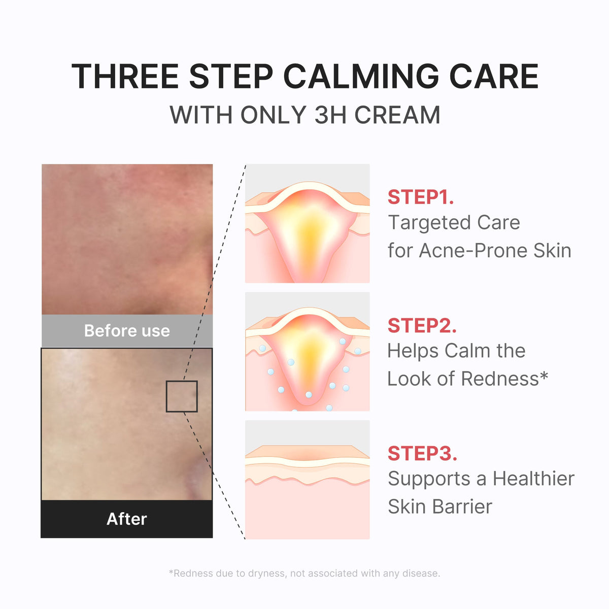 3H Daily Relief Cream T5