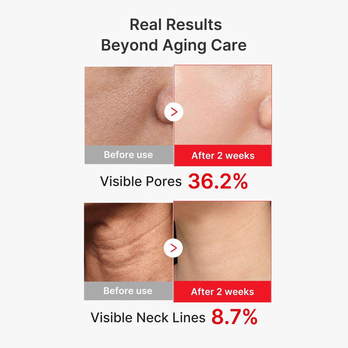 EGF NAD+ Firming Serum J5