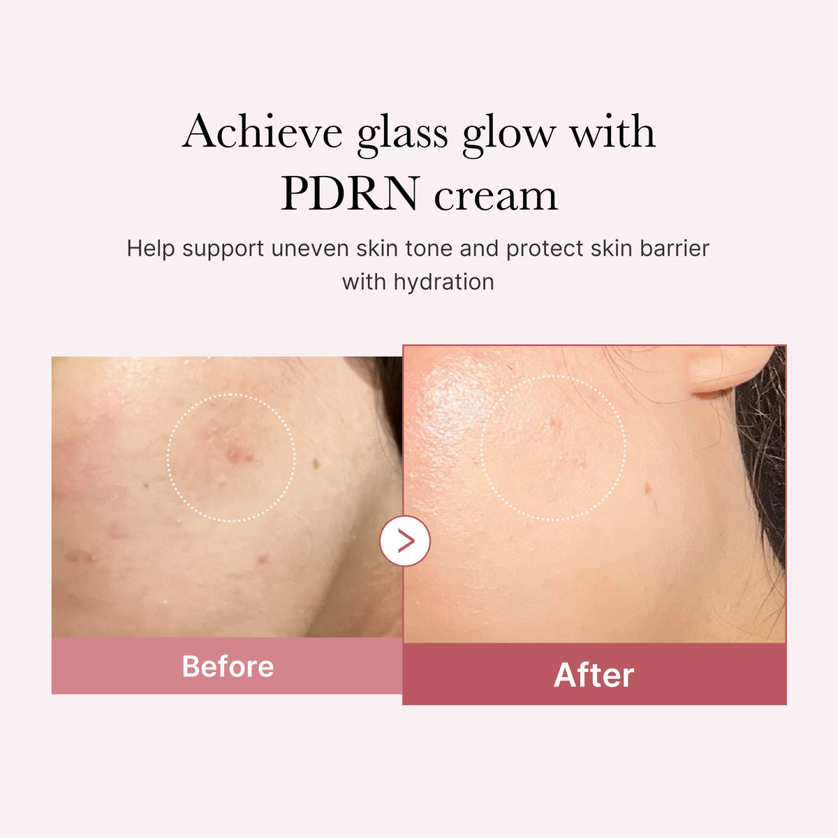 PDRN Pink Peptide Cream U0