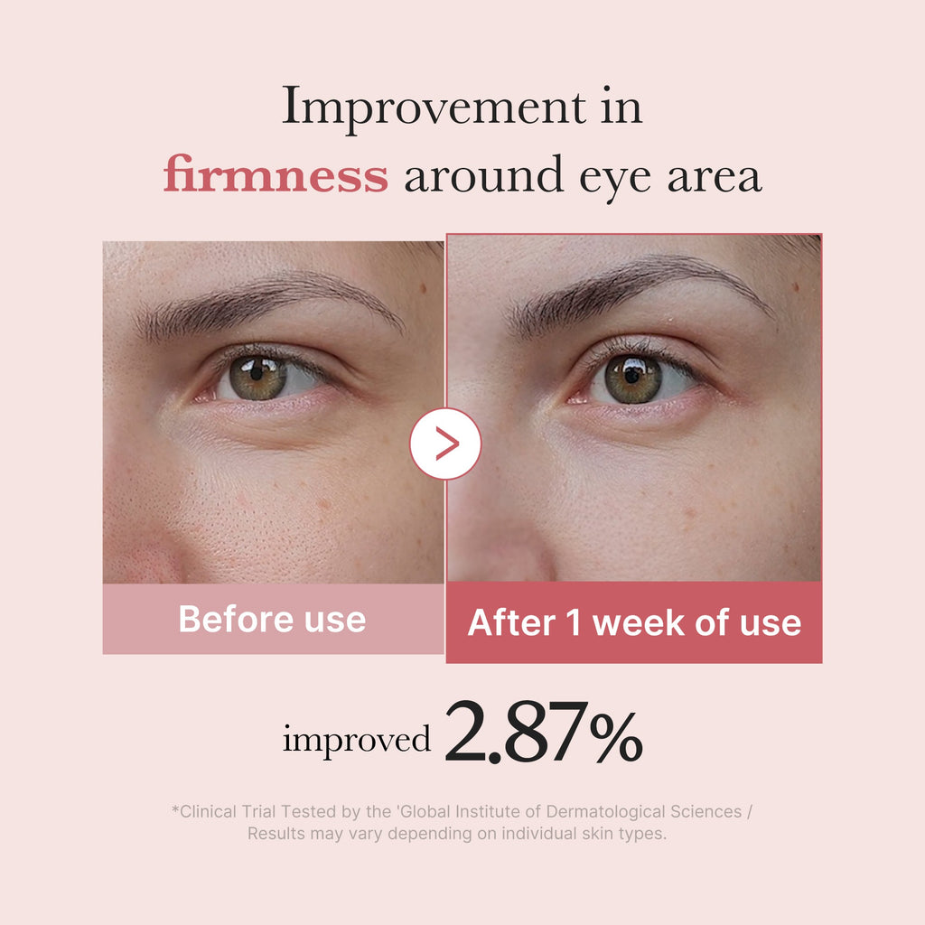 PDRN Pink Peptide Eye Cream M6