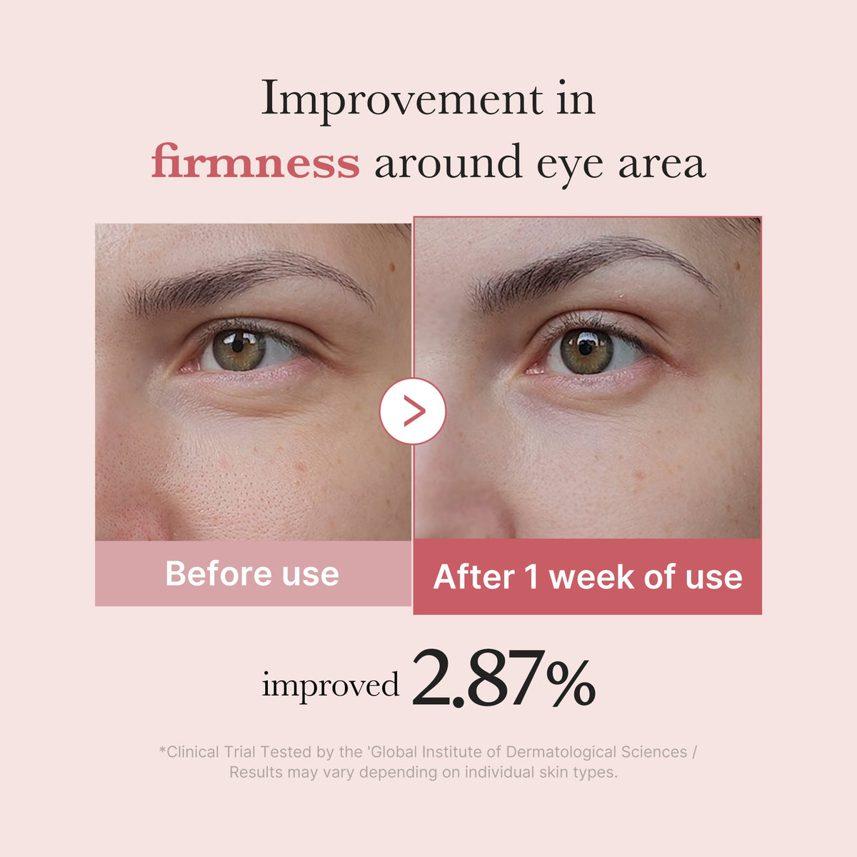 PDRN Pink Peptide Eye Cream M6