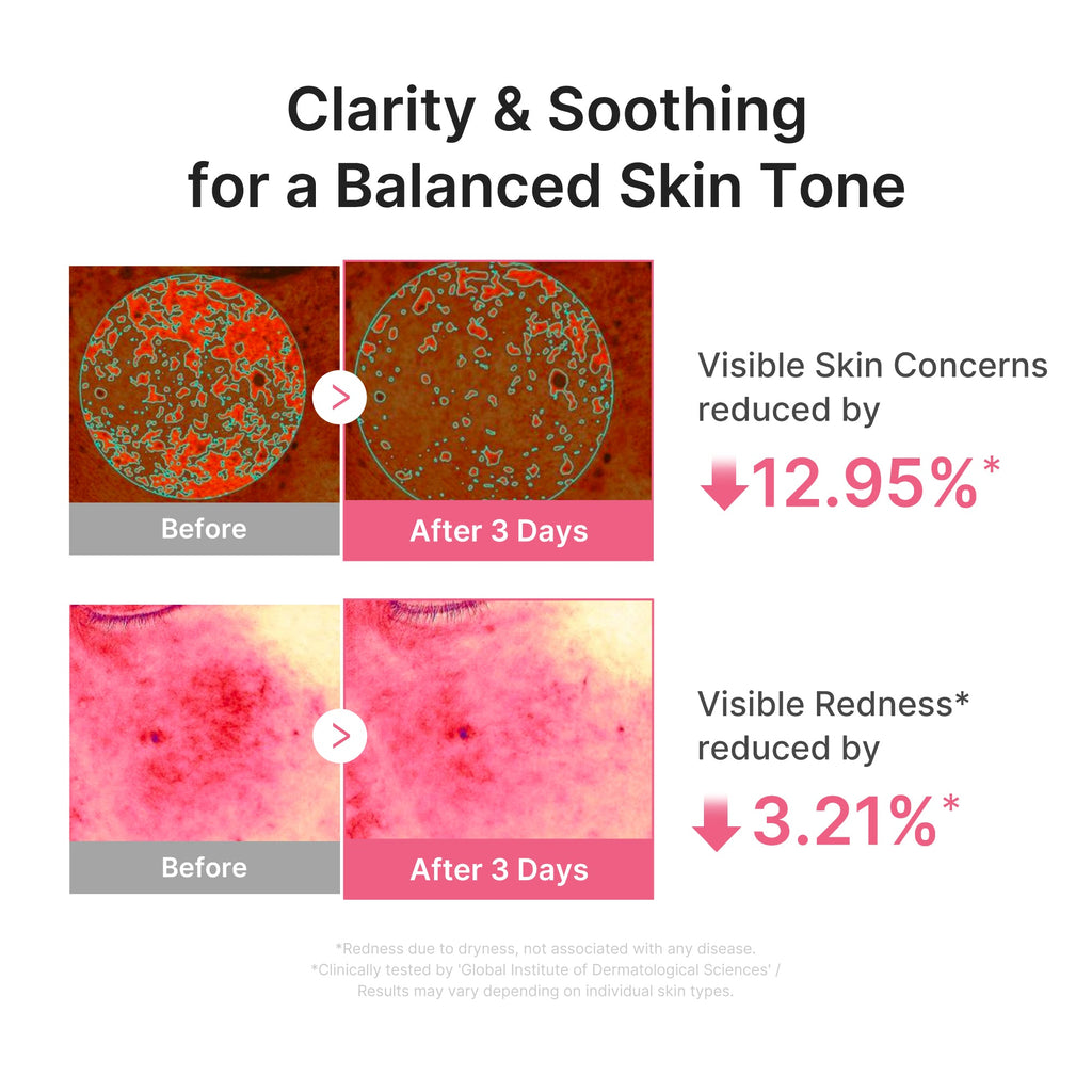 Ultra Light PDRN Pink Peptide Serum U1