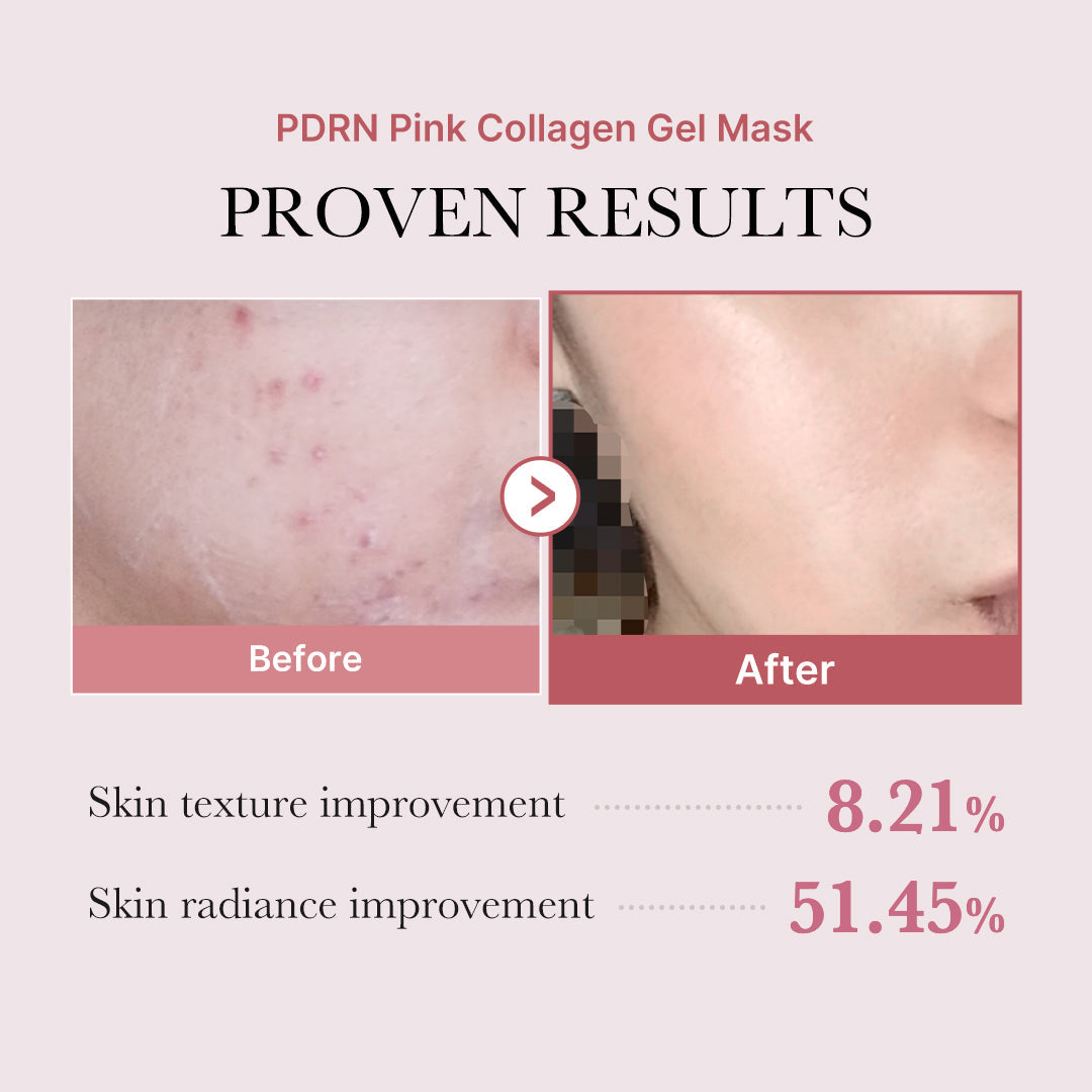 PDRN Pink Glow Full Set Z2