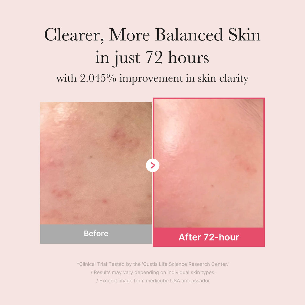 TXA Niacinamide Serum Y3